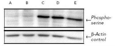 Western Blot Phosphoserine Antibody [HRP]